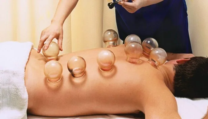 cupping-therapy 