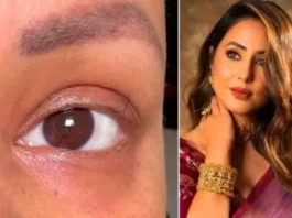 hina-khan-shares-post-losing-her-eyelashes-due-to-chemotherapy