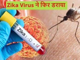 Zika-Virus