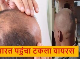 Hair loss Crisis in Maharashtra