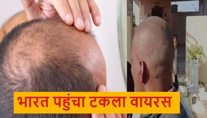 Hair loss Crisis in Maharashtra